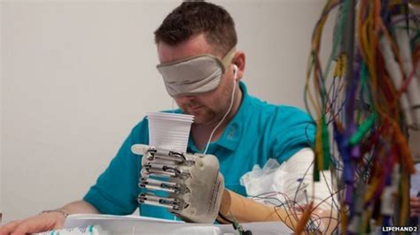 Bionic Hand Allows Patient To Feel Bbc News