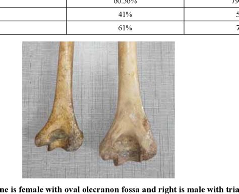 Figure 1 From Sex Determination From Lower End Of Humerus Using