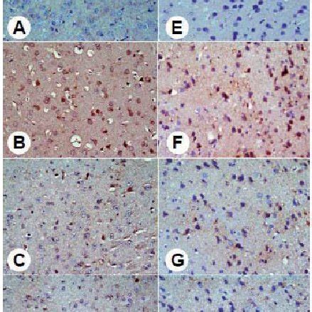 H E Stained Sections From The Rat Cortex And Striatum A Normal