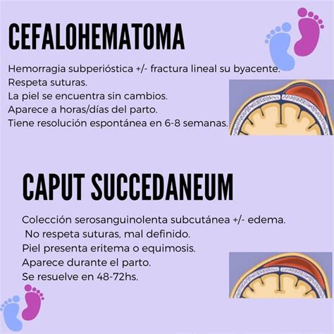 Cefalohematoma Y Caput Succedaneum Lisette Resumediqobste Udocz