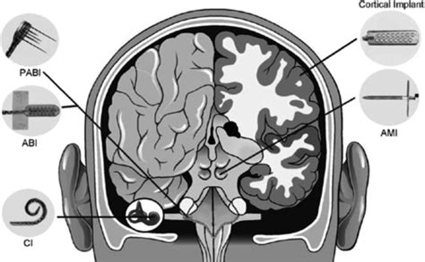 Simplified Schematic Of The Brain Showing The Location Of Electrode Download Scientific Diagram