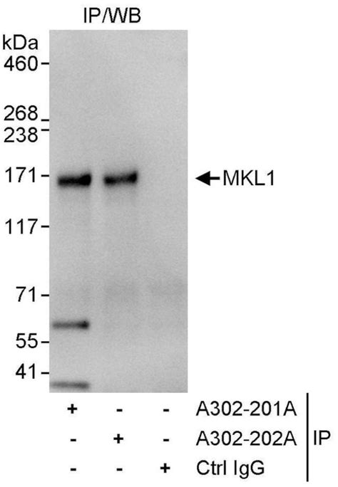 Mkl1 Polyclonal Antibody A302 202a T