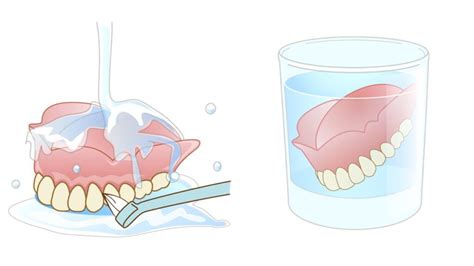 入れ歯の正しいお手入れ方法と注意事項 秋葉原総合歯科クリニック