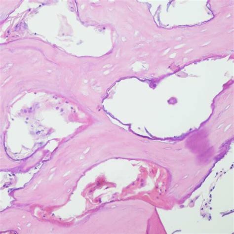Haematoxylin And Eosin H E Stained Section Showing Mature Lamellar