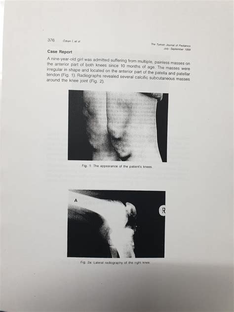 Pdf Tumoral Calcinosis A Case Report