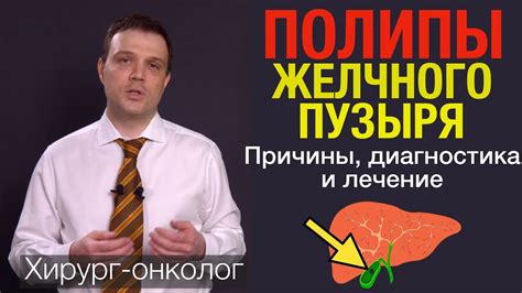 Полипы желчного пузыря Симптомы причины диагностика лечение полипов