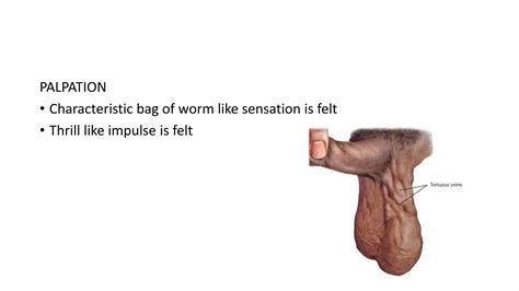 Differential Diagnosis Of Inguinoscrotal Swelling Ppt