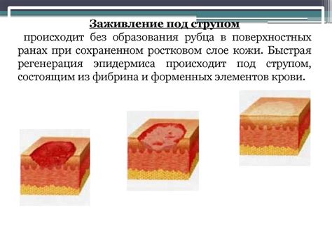 Первичная хирургическая обработка раны. Укушенные раны - презентация онлайн