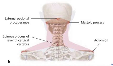 Superficial And Deep Structures Of The Neck L3 1 Flashcards Quizlet