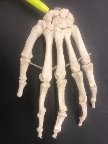 Bones Of Wrist And Hands Flashcards Quizlet