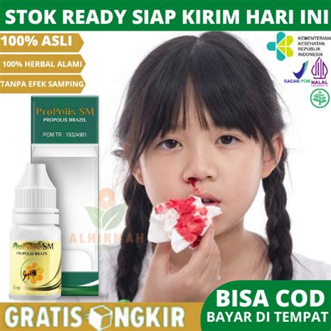 Jual Obat Mimisan Untuk Anak Dan Dewasa Sering Pusing Sakit Kepala