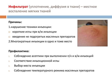 Профилактика постинъекционных осложнений - online presentation