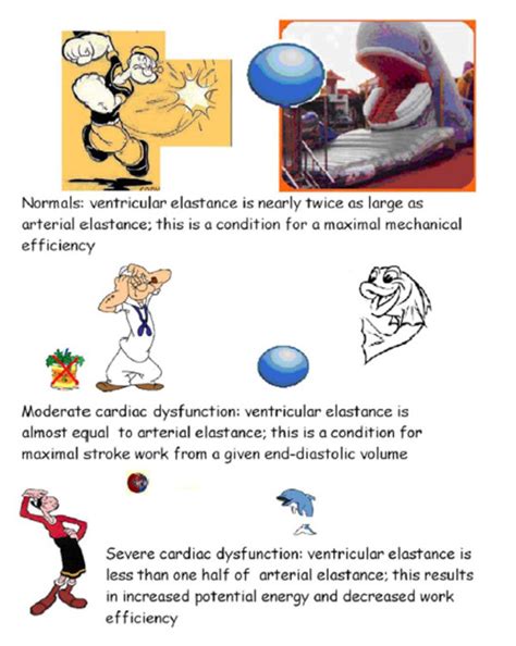 ventricular arterial coupling   cartoon arterial elastance