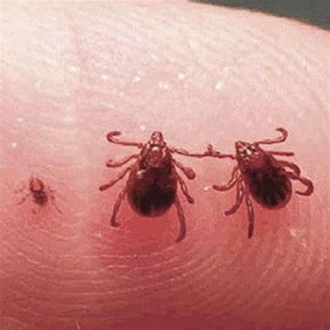 Tick Bite Pictures Symptoms What Does A Tick Bite Look Like Ph