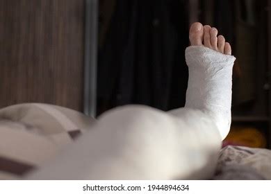 Photo Leg Full Plaster Cast Stock Photo 1944894634 | Shutterstock