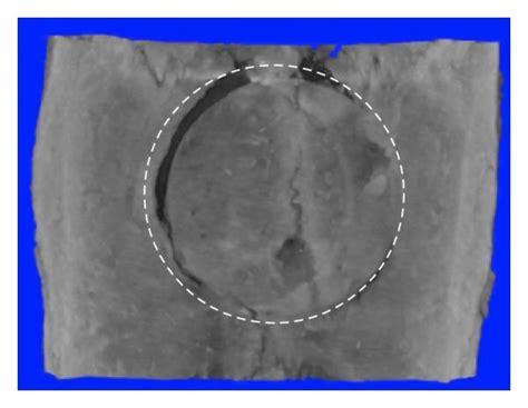 Micro Ct Images Of Critical Sized Calvarial Defects At Weeks Panels