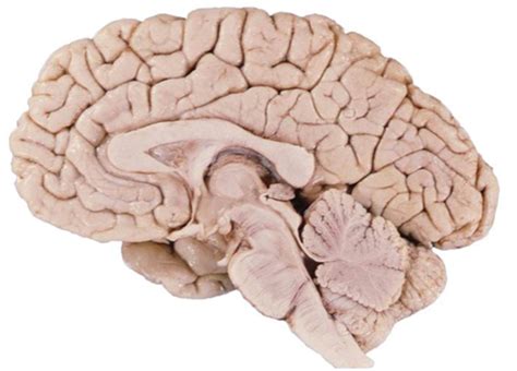 Real Brain Anatomy Diagram Quizlet