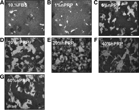 Bright Field Micrographs Of Adipose Derived Mesenchymal Stem Cell Download Scientific Diagram