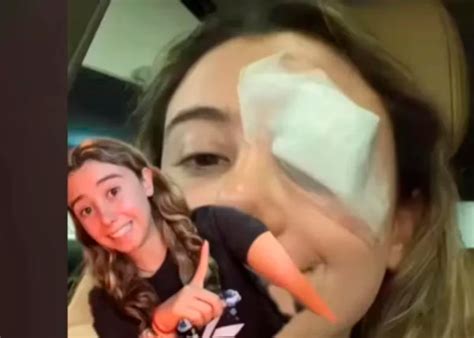 Una Joven Termina En El Hospital Por Truco De Belleza Que Vio En Tiktok