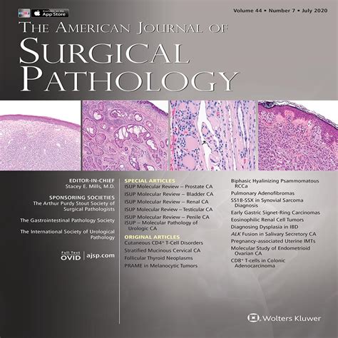 The International Society Of Urological Pathology Consultati The