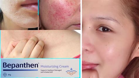 Bepanthen Cream For Damaged And Irritated Skin Youtube