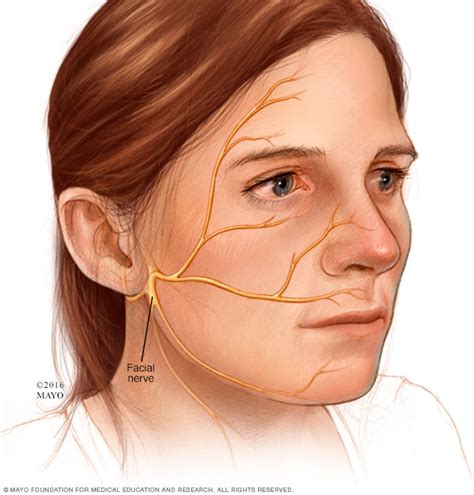 Ramsay Hunt Syndrome Symptoms Causes Mayo Clinic