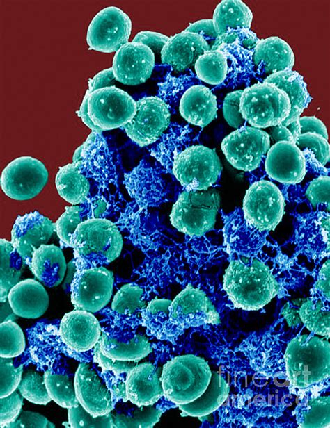 Staphylococcus Epidermidis Bacteria Sem By Science Source 8892 Hot Sex Picture