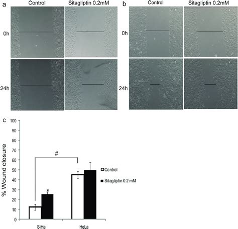 Cell Migration Using The Wound Healing Assay Siha A And Hela B