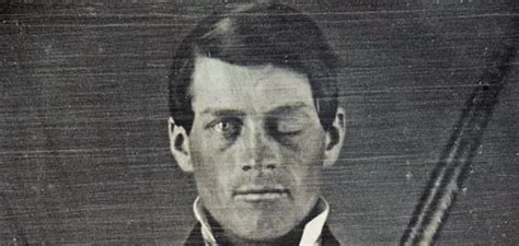 Phineas Gage Neuroscience S Most Famous Patient Smithsonian