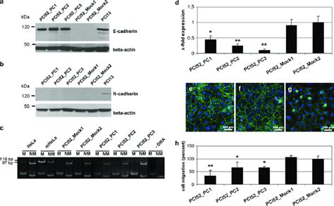 Elevated Soluble E Cadherin During The 58 Off