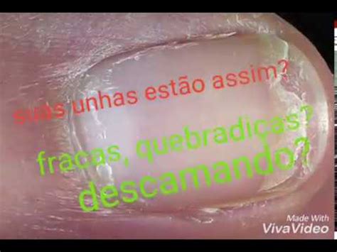 Unha Descamando E Quebradiça - Unhas fracas, quebradiças e descamando? - YouTube