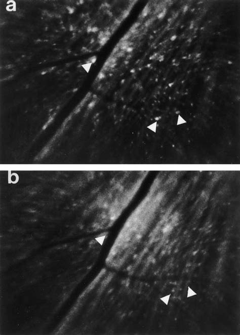 In Vivo Imaging A Retrogradely Labeled Rgcs In A Retina Immediately