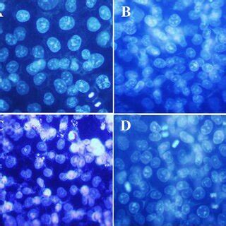 Dapi Staining Changes In Cell Nucleus Indicating Nuclear Fragmentation