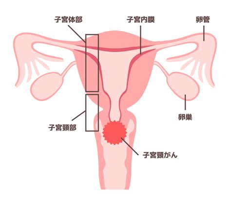 オンライン子宮頸がん相談 おうち病院