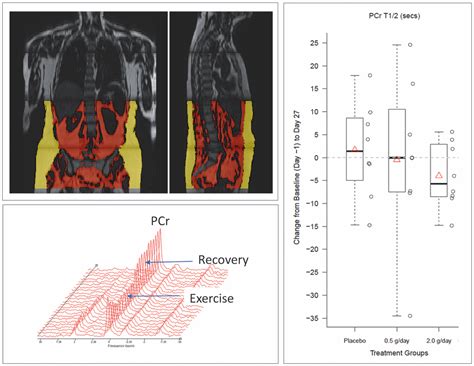 Representative Example Of Magnetic Resonance Images And 31p Magnetic Download Scientific