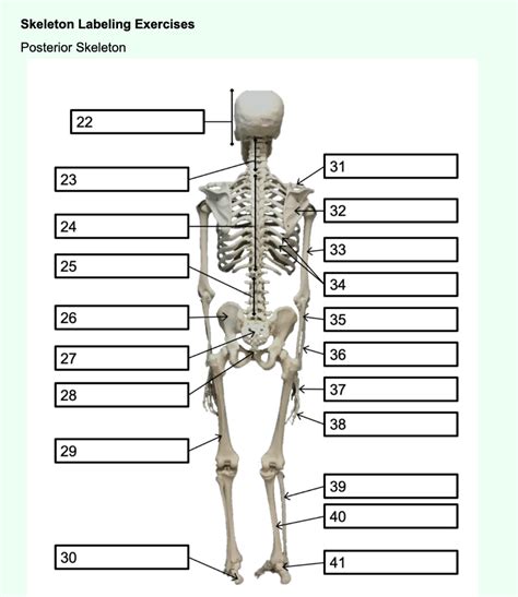 Solved Bone Names Axial Skeleton Bone Names Skull Bones Chegg