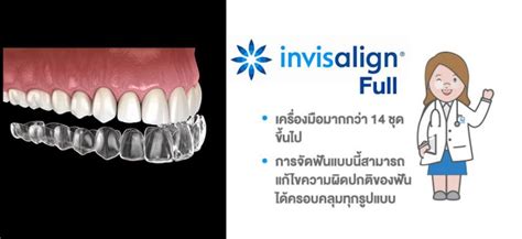 จัดฟันใส Invisalign มีกี่แบบ ราคาเท่าไหร่ ทำไมดาราถึงนิยม