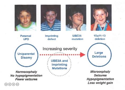 Genetics Of As Angelman Syndrome Foundation