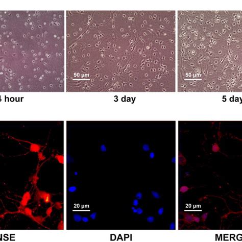 Identification Of The Purity Of Rat Cortical Neurons A Primary Rat