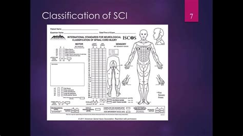 Classifying Spinal Cord Injuries Using Asia Scoring 46 Off