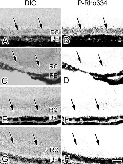 Light Micrographs Of Dic A C E G And P Rho334 Immunostaining