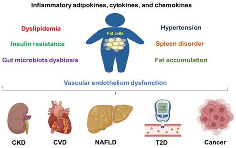 The Related Metabolic Diseases And Treatments Of Obesity Encyclopedia