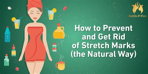 How To Get Rid Of Stretch Marks And Prevent Them The Natural Way