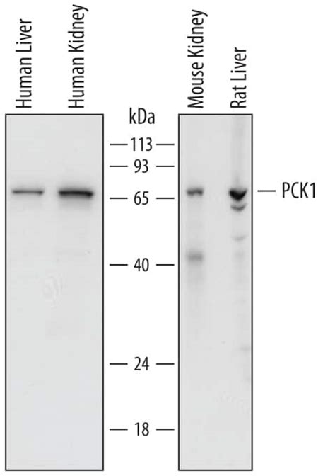 Pck1 Antibodies Novus Biologicals