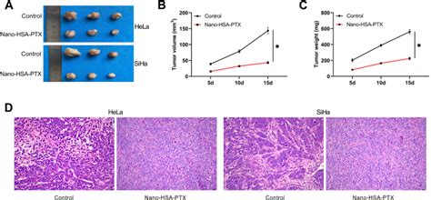 Human Serum Albumin Bound Paclitaxel Nanoparticle Inhibits Cervical