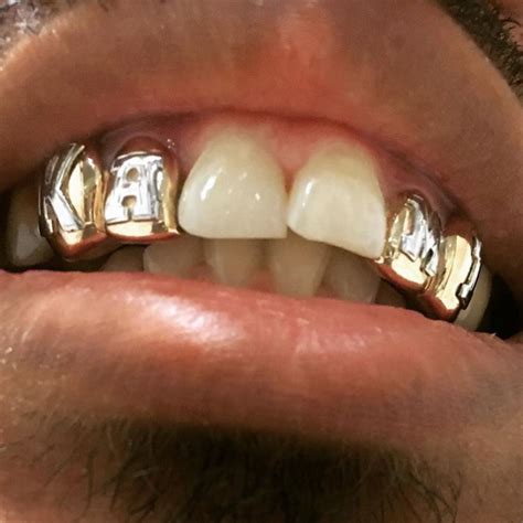 K Solid Gold Top Or Bottom Gold Teeth Master