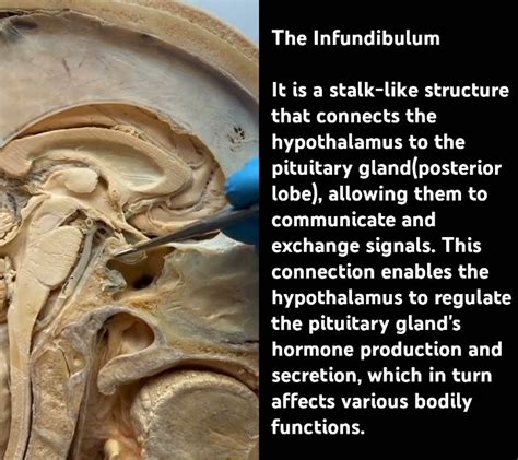 Infundibulum Function #mbbs #anatomy #mbbs - YouTube