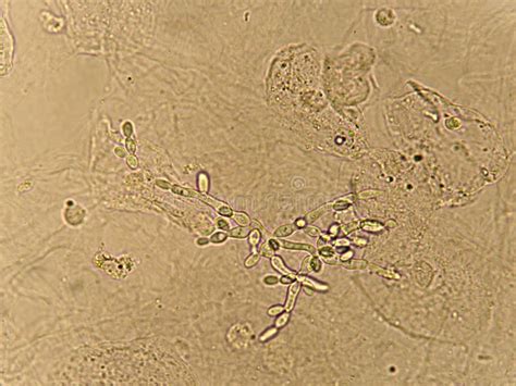 Pseudohyphae And Budding Yeast Cells Stock Image Image Of Health