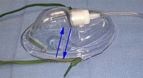 Oxygen Delivery Devices Anesthesia Airway Management Aam Airway Management Oxygen Delivery