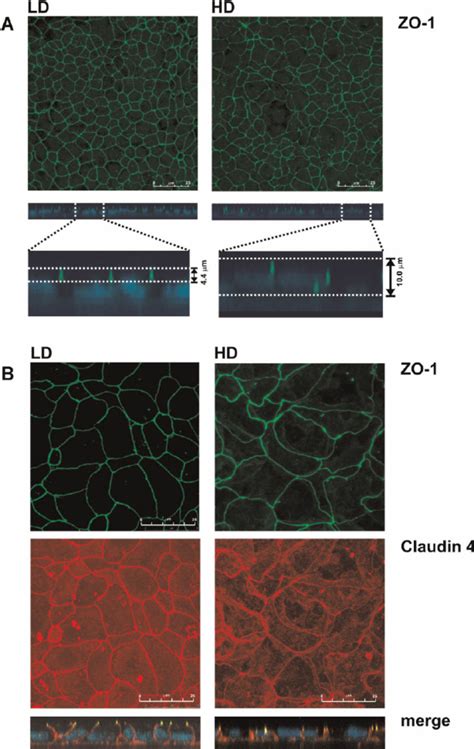 Localization By Confocal Microscopy Of Caco Tight Junction Proteins